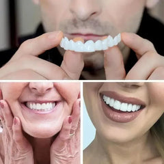 SMILEFIT PRO – SET ADAPTABIL DE DINȚI PENTRU UN ZÂMBET PERFECT
